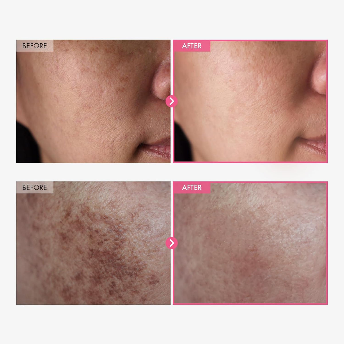 Advanced Arbutin Brightening Cream
